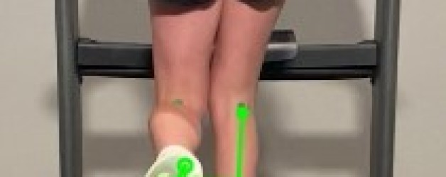 Case Study: Young Athlete Eliminates Knee Pain and Achieves Personal Record Through Targeted Intervention: 1 session Gait Analysis and Personalized Program